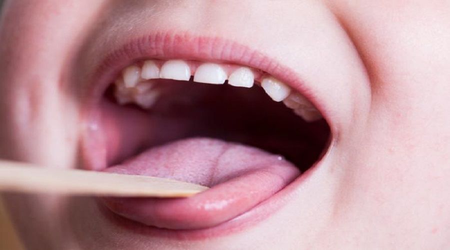 Çocuklarda uzun süren ateş o hastalığın habercisi olabilir