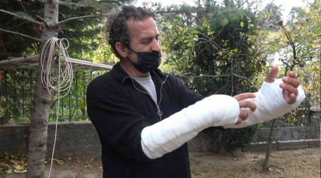 Husumetlisine pitbull cinsi köpekle saldırdı