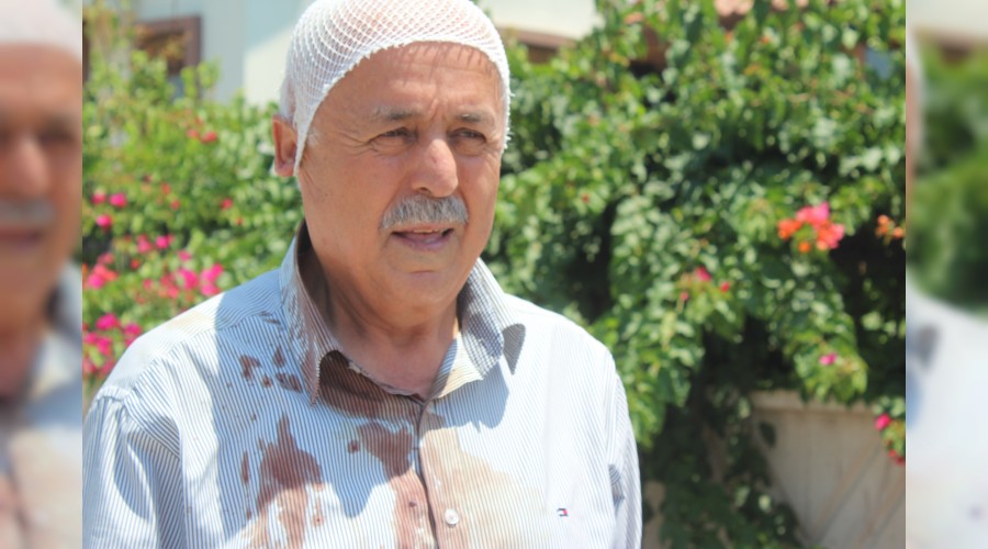 Köpeklerin saldırısına bir yenisi eklendi