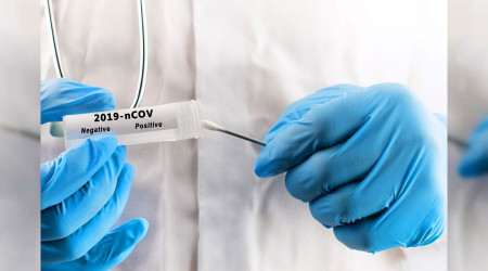 PCR testlerinde varyant endişesi