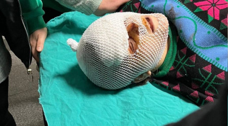 Barışma teklifini reddeden eski dini nikahlı eşine dehşeti yaşattı