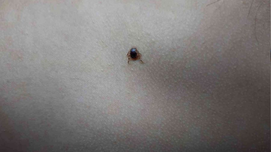 �ocu�un s�rt�ndaki kene hastanede ��kart�ld�