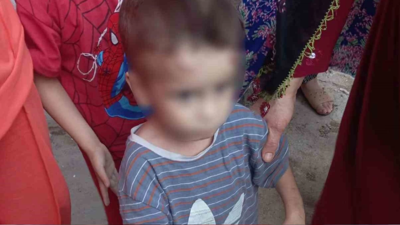 �ocuk i�kenceden kurtar�ld�...Anne ve babas� g�zalt�nda