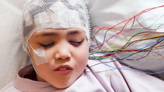 Epilepsi (Sara) Hastalığına iyi gelen Bitkiler