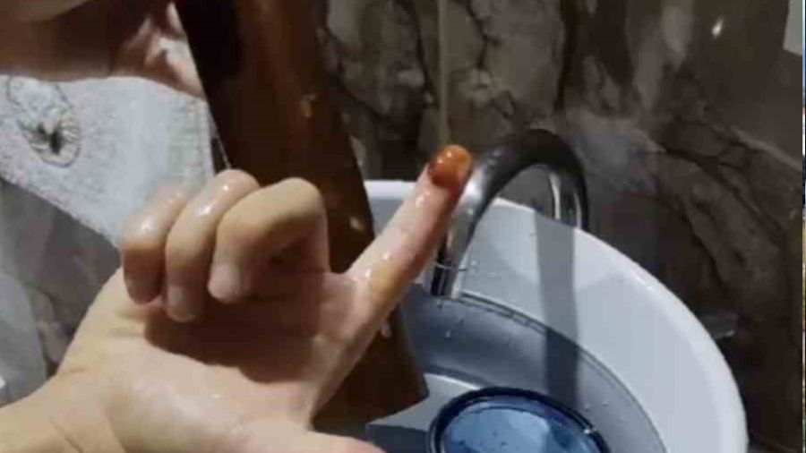 me suyu filtresi 5 gnde amura dnd