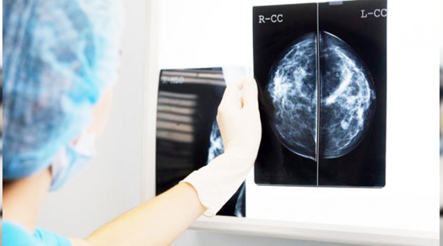 Yapay zeka doktorlar�n pabucunu dama att�