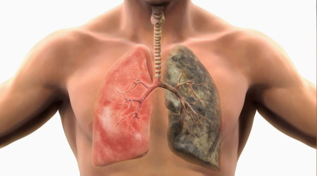 Akciğer kanserine karşı 3B kuralı unutulmamalı