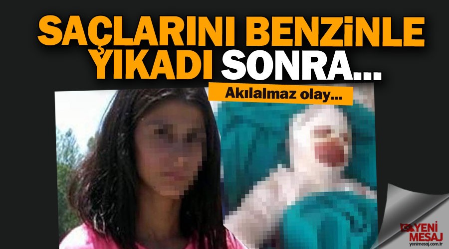Akılalmaz olay! Saçlarını benzinle yıkadı sonra...