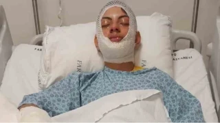 Ate�e benzin d�kt�, facian�n e�i�inden d�nd�