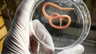 Ba��rsaklardaki parazitleri temizleyen �ifal� bitkiler