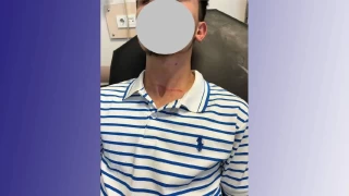 Babo kpein saldrsna urayan motosikletli kurye yaraland