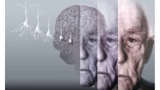 Demans ve Alzheimer Ayn ey mi? Aralarndaki Fark Nedir?