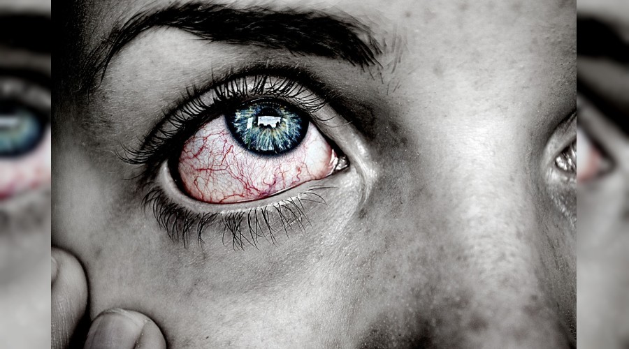 D�nyada  salg�n boyutuna ula�an diyabetin g�ze verdi�i hasarlara dikkat