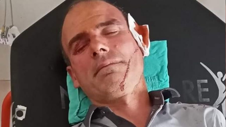 Hemşireye yardıma gelen güvenlik görevlisi darp edildi