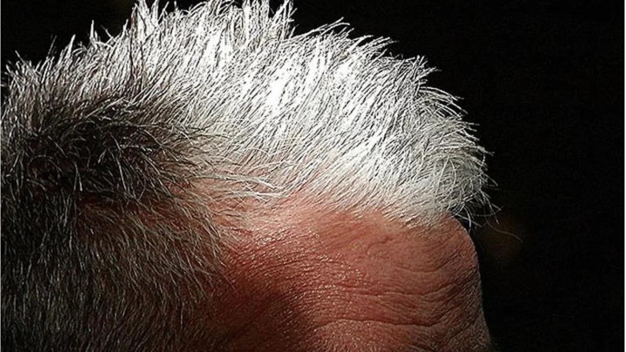 İnsan vücudunda ilk hangi kıllar beyazlar?