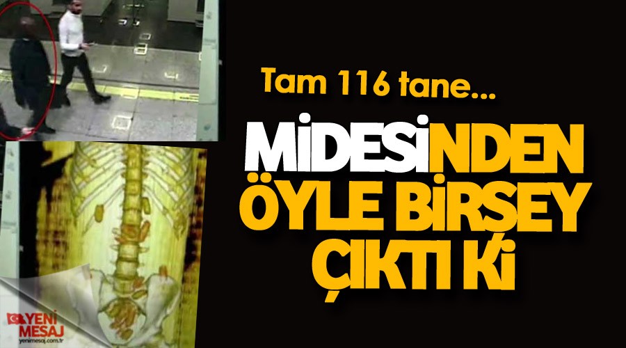 Midesinden öyle bir şey çıktı ki... tam 116 tane