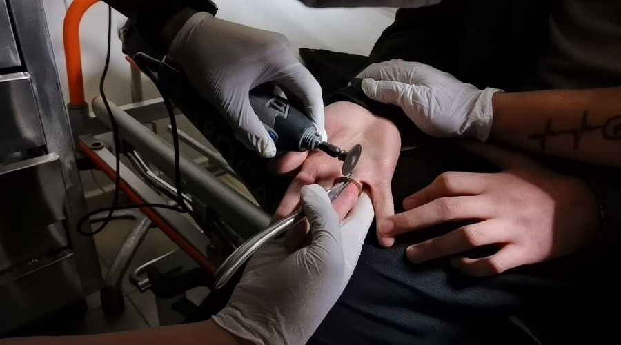 Parma��na 1 TL s�k��t�