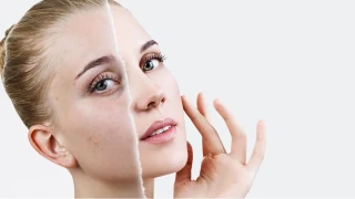 Sa�l�kl� cilt bronz de�il, korunmu� cilttir