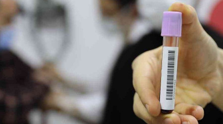 Samsun'da bin 176 çifte SMA taraması