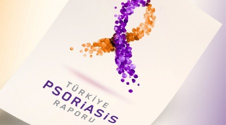 Sedefin ekonomik yükü ağır