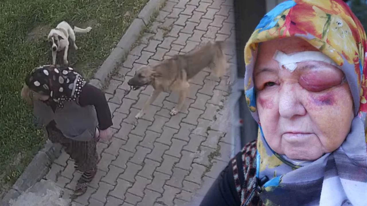 Babo kpek deheti kamerada: Yaralanan kadn tannmaz hale geldi