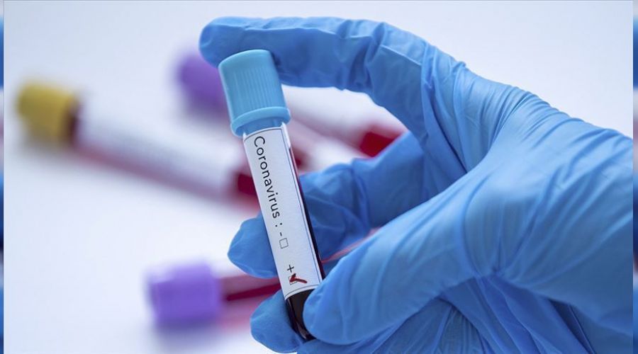 Bir hakemin testi pozitif ��kt�