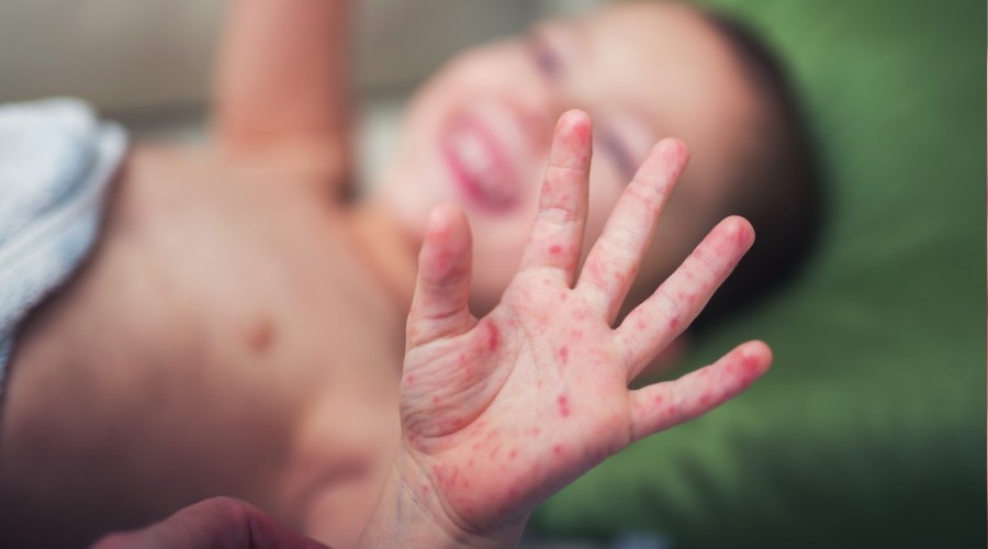 C�zzamda art�� var