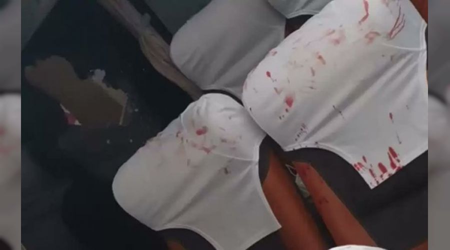 Futbol �iddetinde yeni boyut! Bomba att�lar