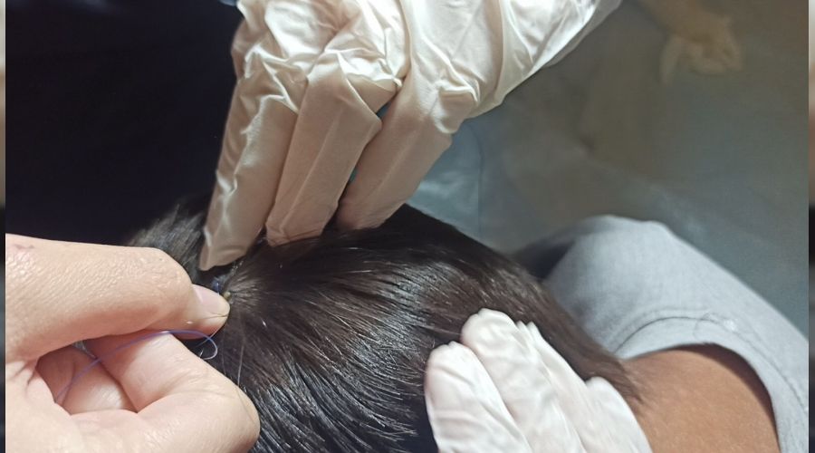 Gercüş'te 5 yaşındaki çocuğu kene ısırdı