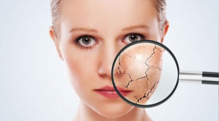 Hava sıcaklıkları artıyor, cilt kuruluğu olanlar nasıl önlemler almalı