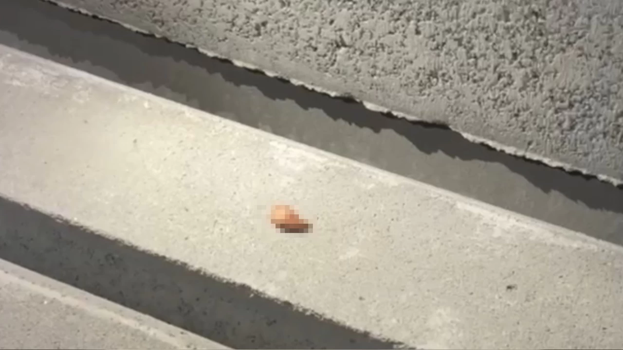 Kazada s�r�c�n�n kopan parma��n� dakikalarca arad�lar