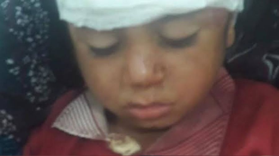 �anl�urfa'da at�n tepti�i �ocuk yaraland�