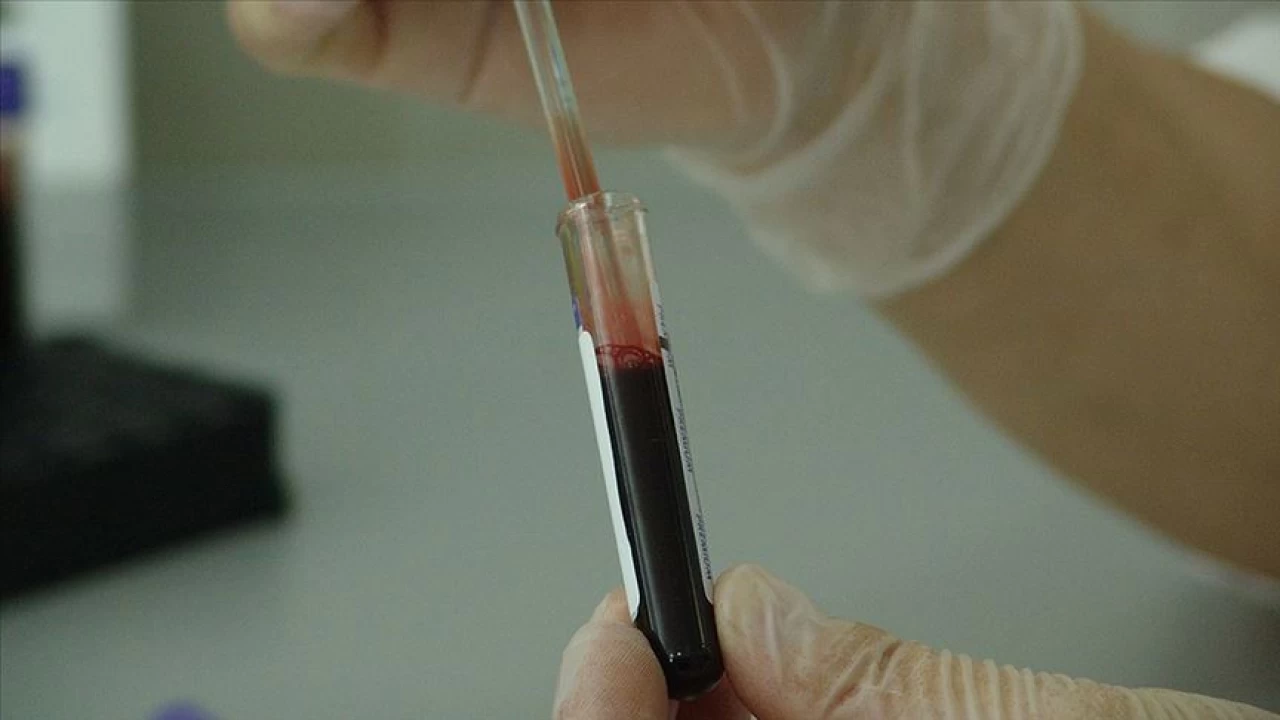Sepsis yani kan zehirlenmesi sessiz bir tehlikedir