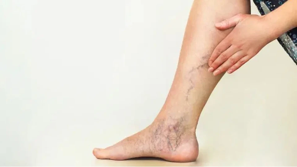 Varis, yaln�zca estetik bir sorun de�il