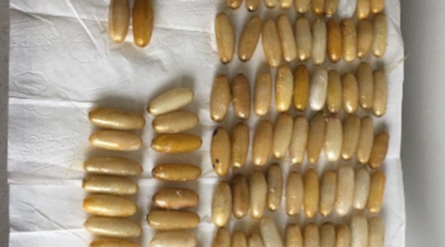 Havalimanı'ndaki yolcunun midesinden 93 kapsül uyuşturucu çıktı