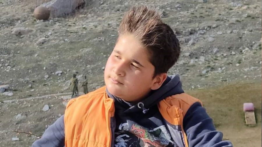 Av tüfeği ile yaralanan çocuk hayatını kaybetti