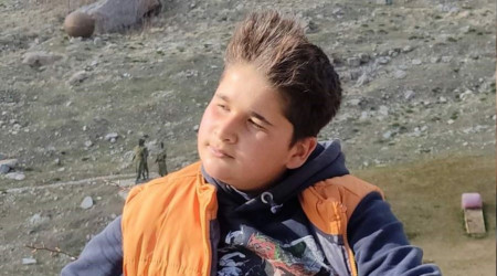 Av tüfeği ile yaralanan çocuk hayatını kaybetti