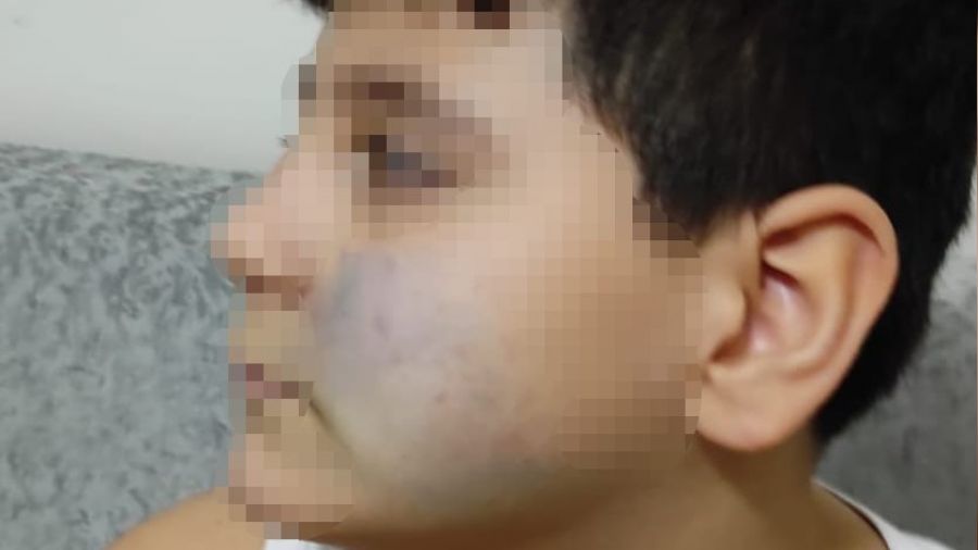 Başkent'te akran şiddeti iddiası