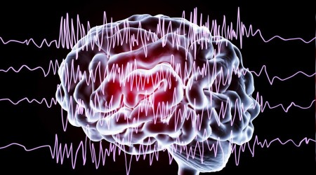 Epilepsi tedavi edilebilen bir hastalk
