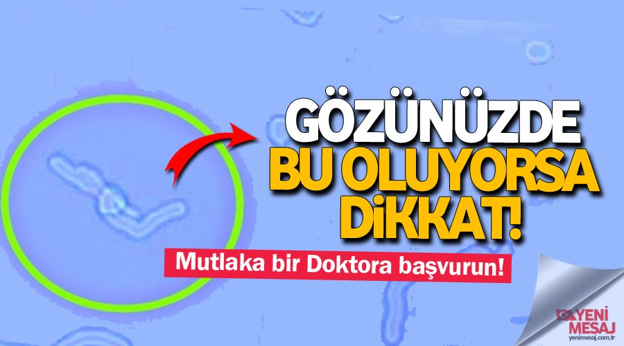 Gozunuzde Bu Oluyorsa Dikkat Yeni Mesaj