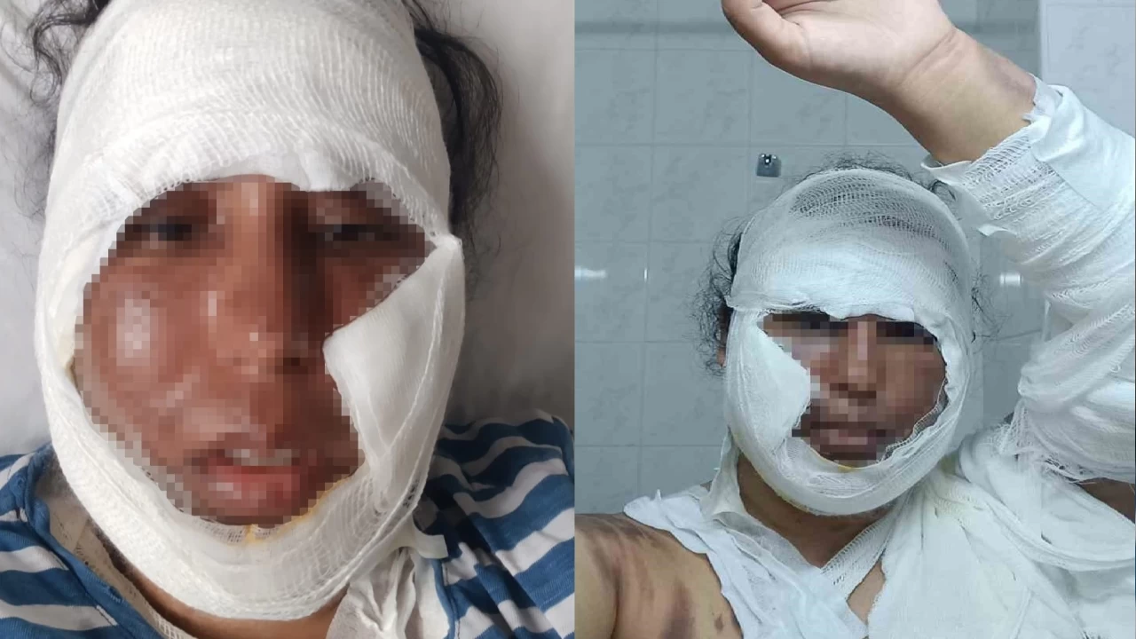 Sakarya'da gelin g�r�mce tart��mas� hastanede son buldu