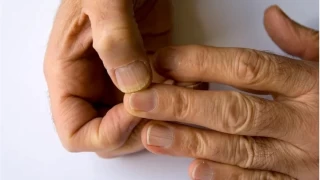 Tırnaklarım Çatlıyor: Yaş, Stres veya Daha Korkunç Bir Sorun mu?