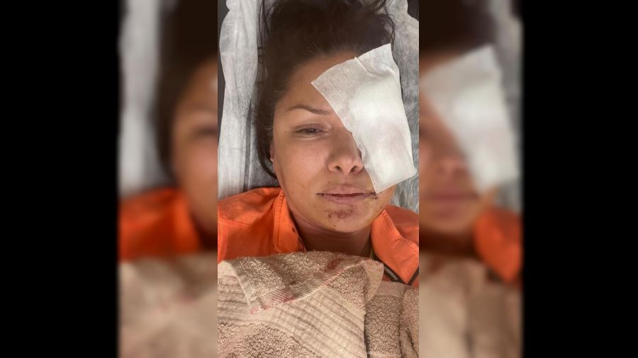 Ünlü şarkıcı Tuğba Altıntop'a köpek saldırdı