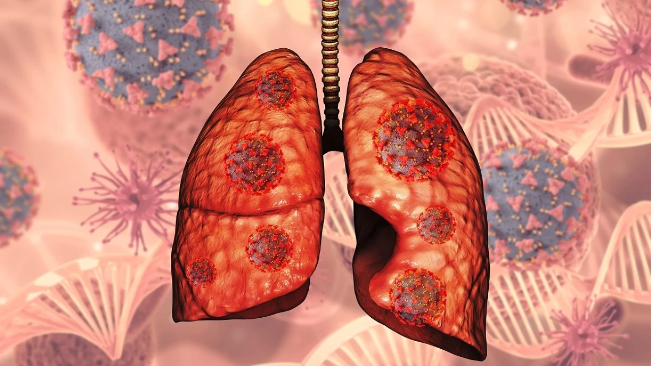 Verem hala d�nya genelinde �nemli bir sa�l�k sorunudur