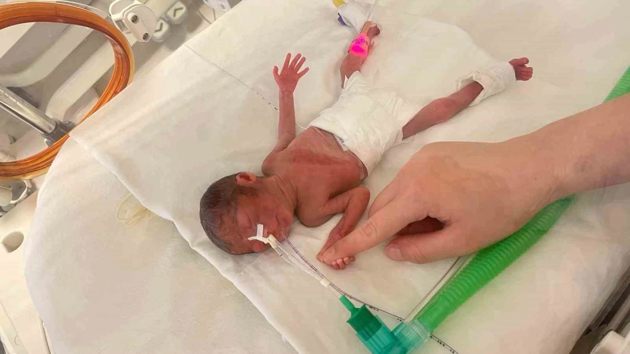 400 gram do�an Aylin bebek hayata tutundu