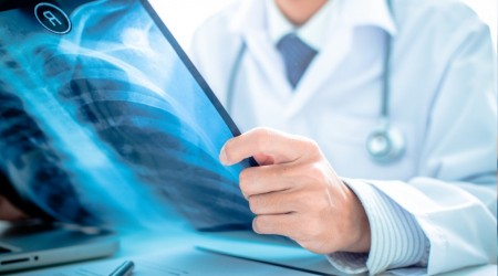 Akciğer kanserinde ilk belirtiye dikkat!