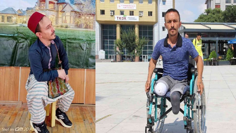 Bir yılda iki bacağını da kaybetti