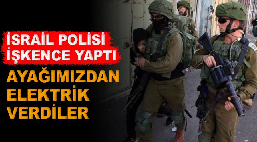 Bizi uykudan uyandırıp ayağımızdan elektrik verdiler