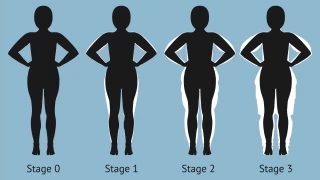 Diyet ve Spor Zayflamak in Yetmiyorsa Lipdeme Dikkat