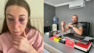 Dokuz kafa darbesine dokuz yıl hapis istemi
